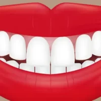 Teeth Whitener - Photo Editor